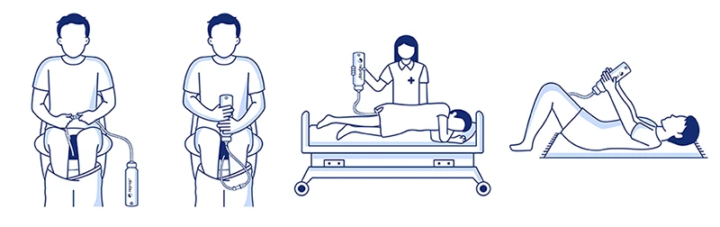 Anwendung des Klistiergerät Reprop® Clyster Basic