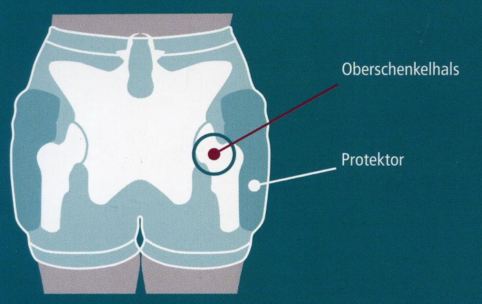 Artikelbild 2 des Artikels “Hüftschutzhose mit Wäscheschutz, suprima bodyguard 1411 “